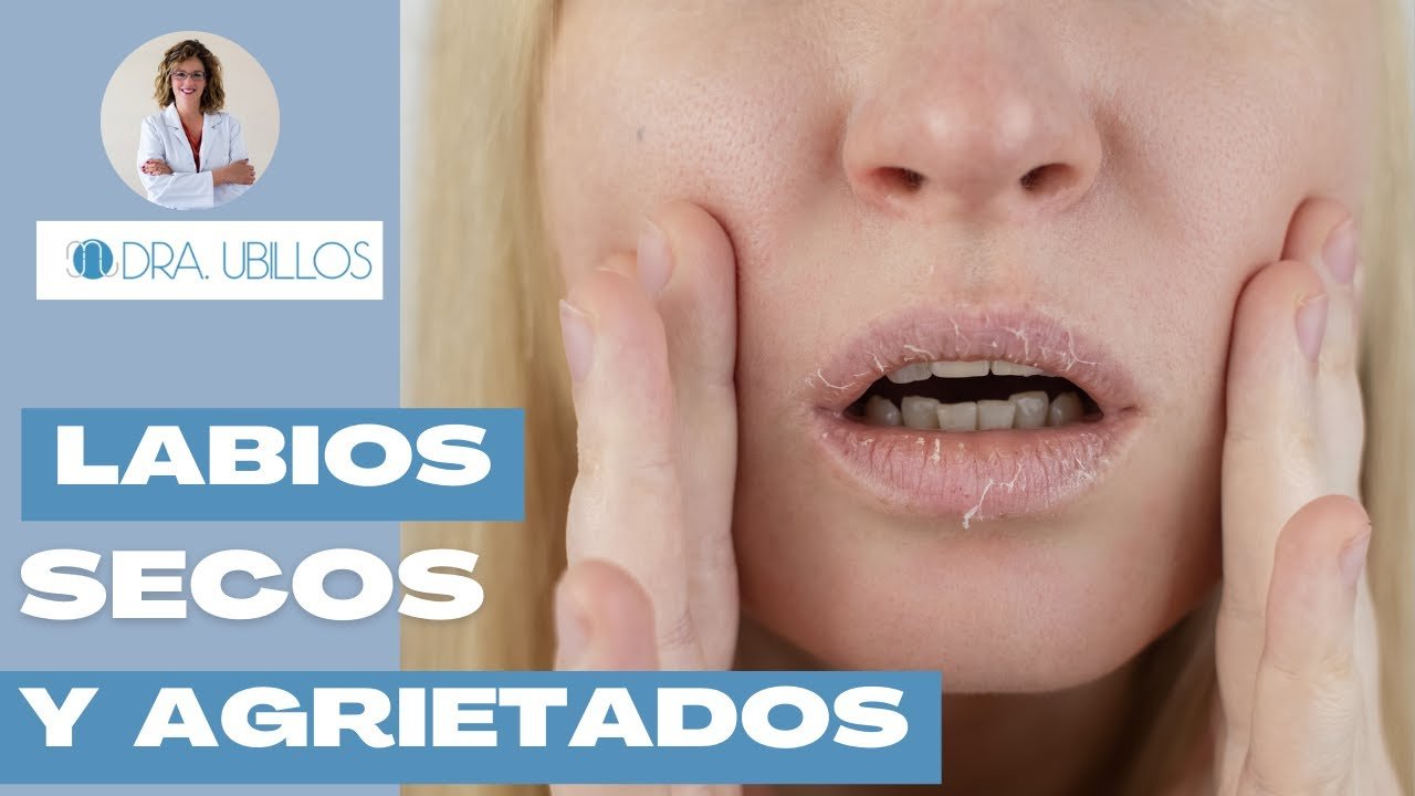 ¿Cómo evitar que los labios se resequen por la noche?