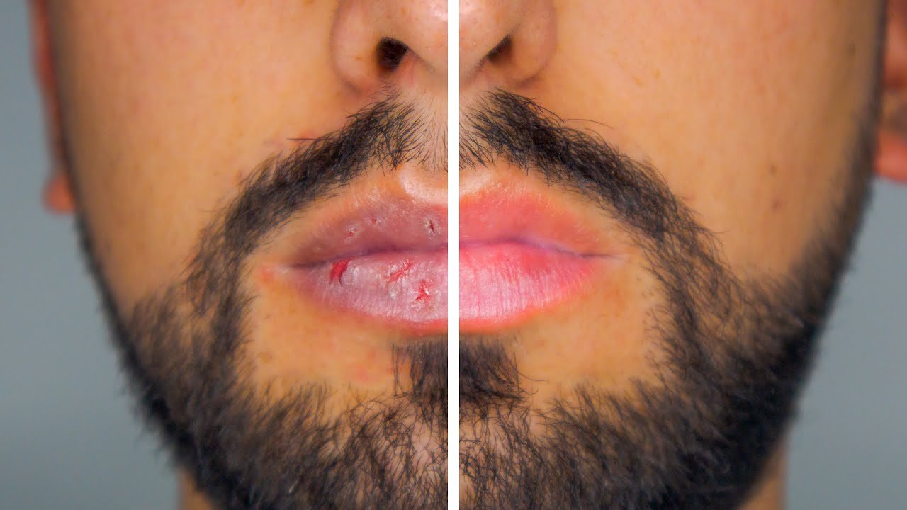¿Cómo hidratar los labios antes de dormir?