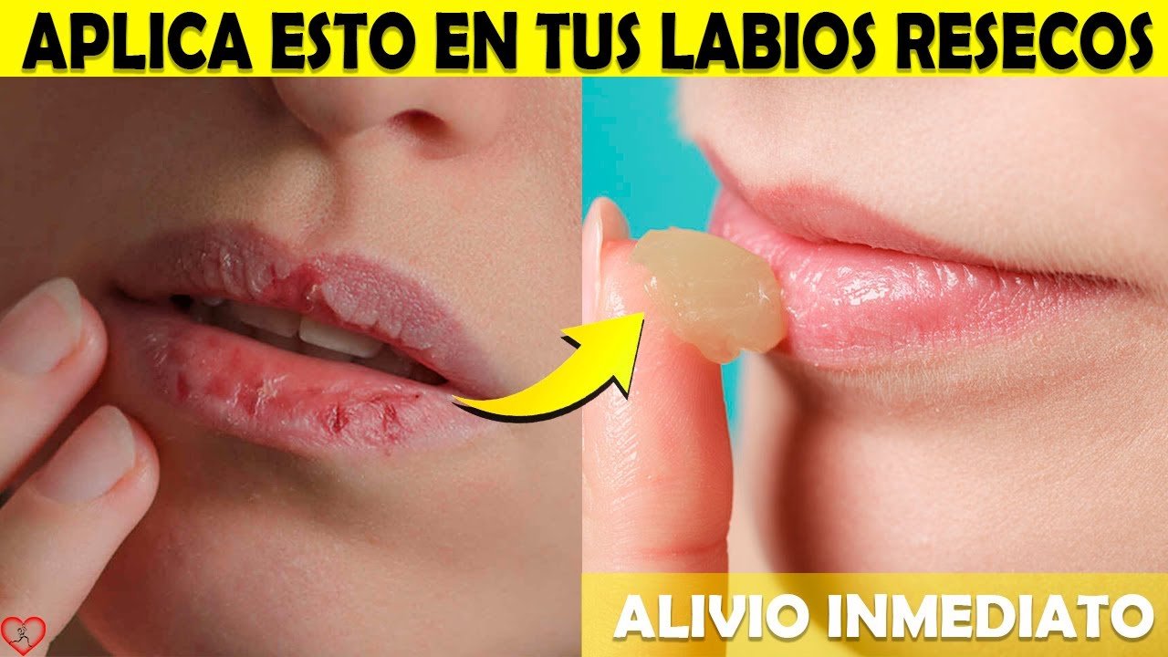 ¿Qué productos naturales funcionan para hidratar los labios?