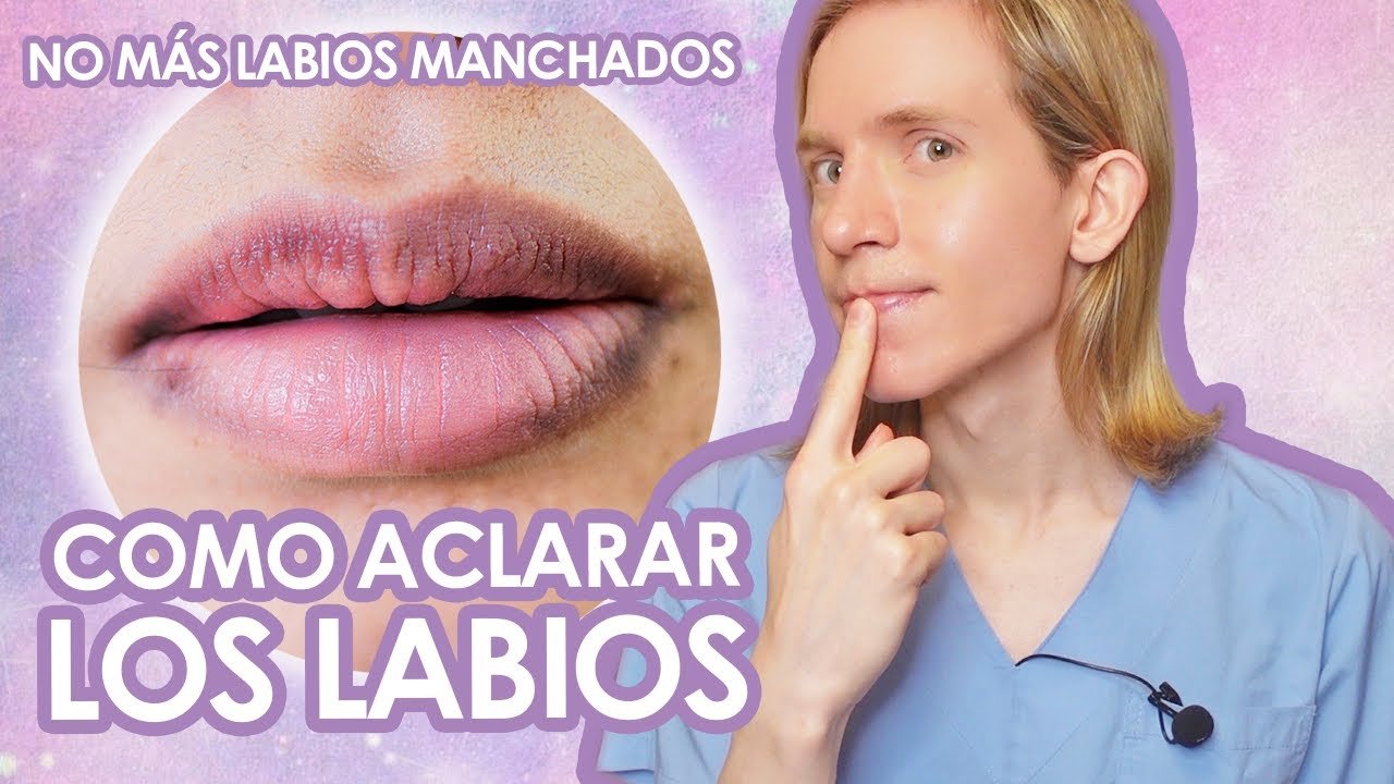 Causas frecuentes de labios oscuros