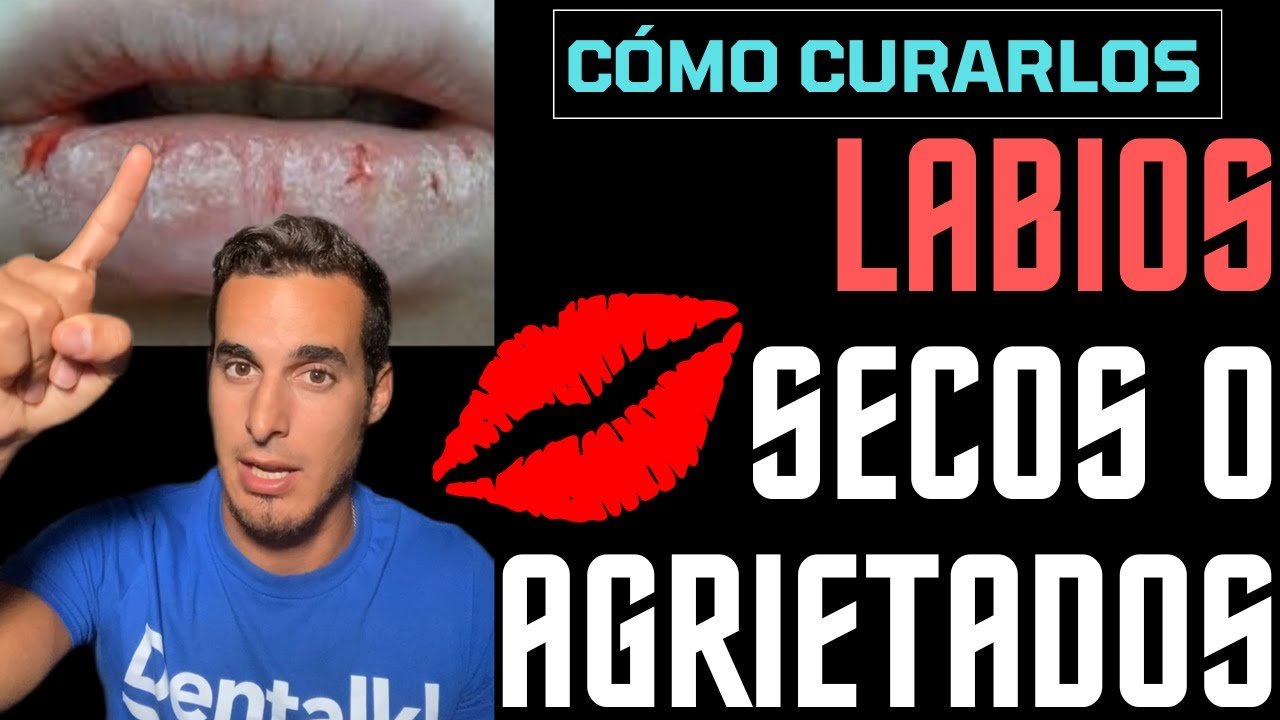 Cómo prevenir labios que sangran