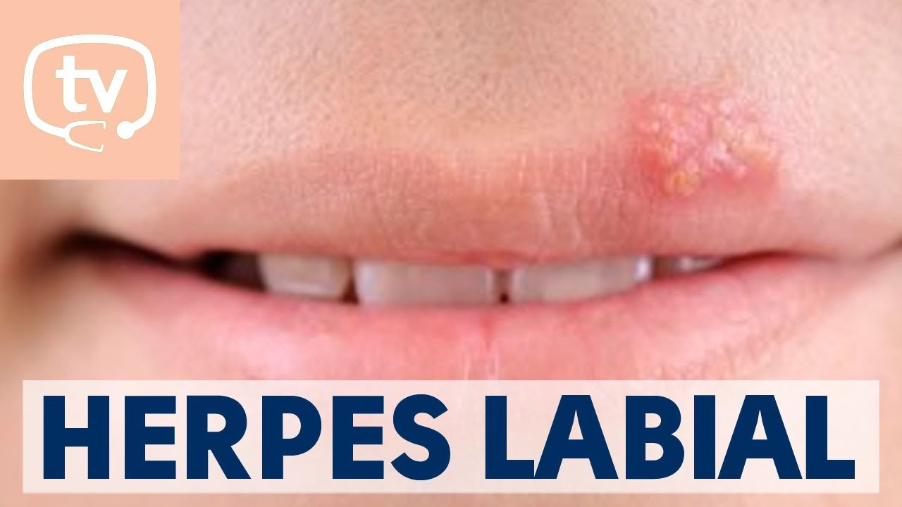 Cómo prevenir labios inflamados