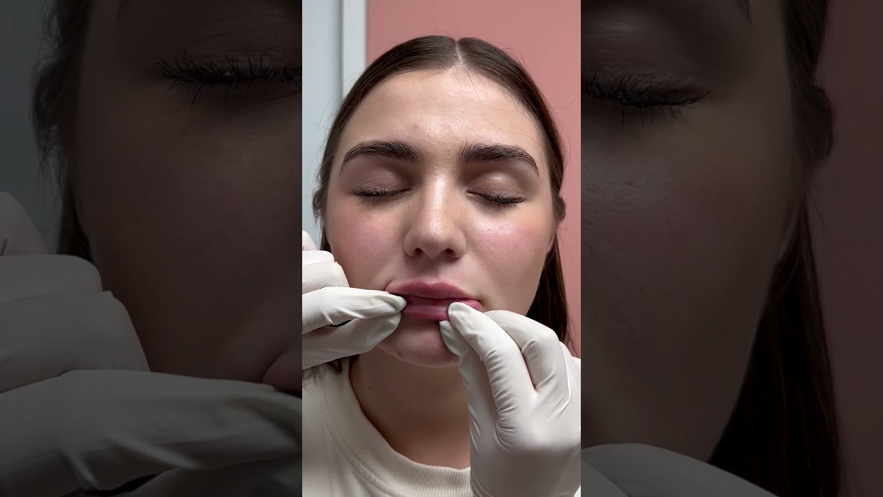 Guía completa para labios en mal estado