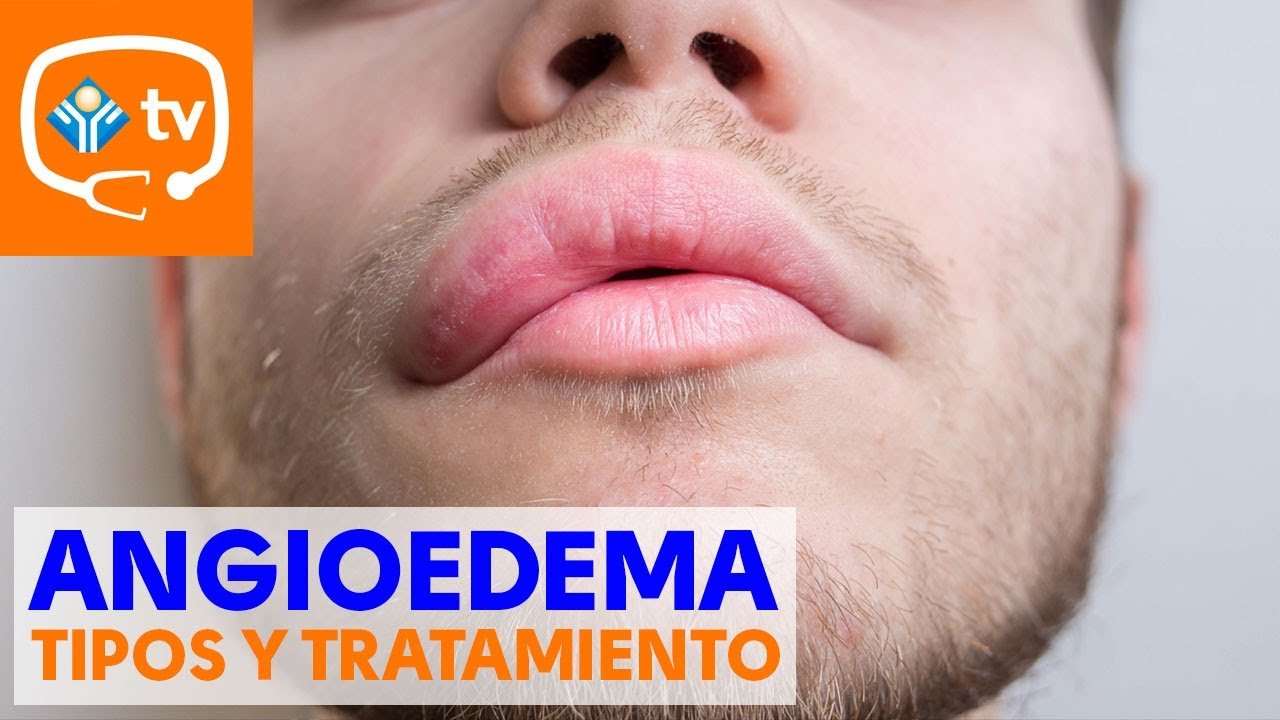 Tratamientos intensivos para labios con alergia