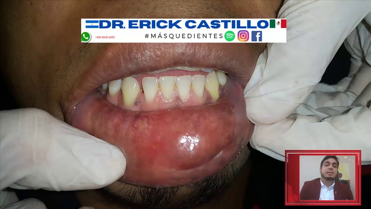 Lo que arruina pasar la lengua por los labios