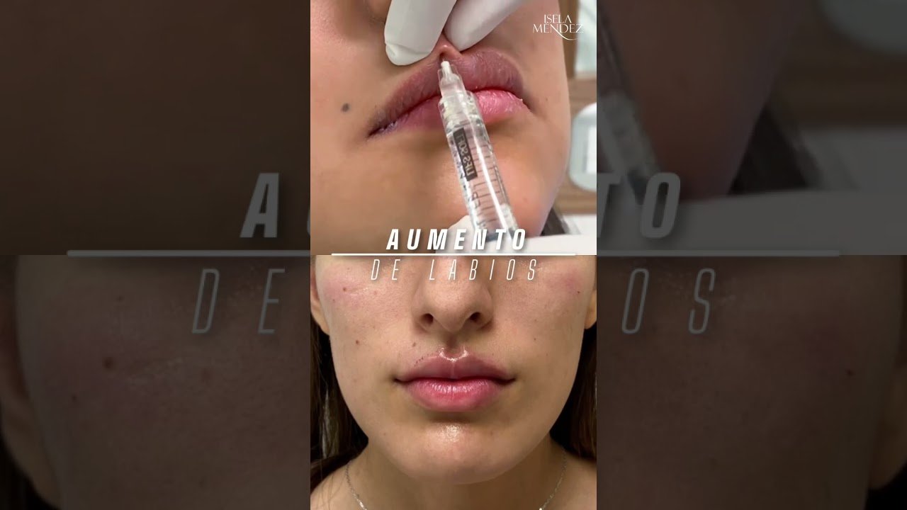 Descuidos comunes con hidratar los labios