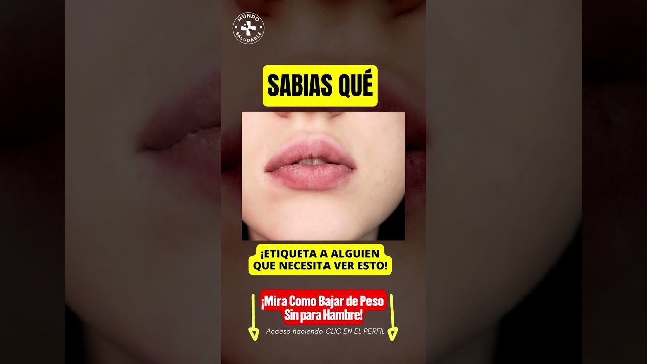 Rutinas equivocadas en ignorar señales de labios agrietados